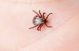 Leczenie Boreliozy odkleszczowa Neuroborelioza KZM Poznań