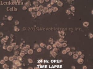 Biorezonans - Plazmoterapia